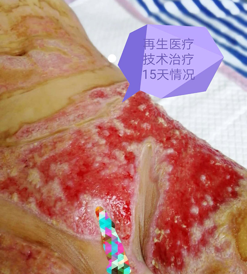 Ò»¾º¼¼ - ÑÇÖÞ×î´óµÄµç¾ºÆ½Ì¨